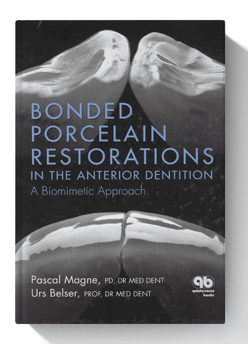 Bonded Porcelain Restorations in the Anterior Dentition: A Biomimetic Approach 1st Edition