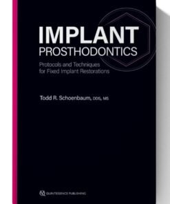 Implant Prosthodontics: Protocols and Techniques for Fixed Implant Restorations (Scanned)