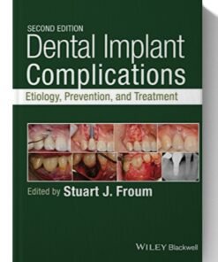 Dental Implant Complications: Etiology, Prevention, and Treatment 2nd Edition
