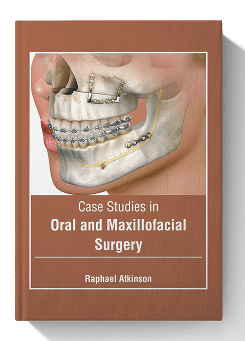 Case Studies in Oral and Maxillofacial Surgery