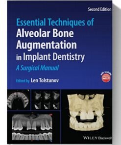 Essential Techniques of Alveolar Bone Augmentation in Implant Dentistry: A Surgical Manual 2nd Edition