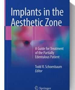 Implants in the Aesthetic Zone: A Guide for Treatment of the Partially Edentulous Patient 1st ed.