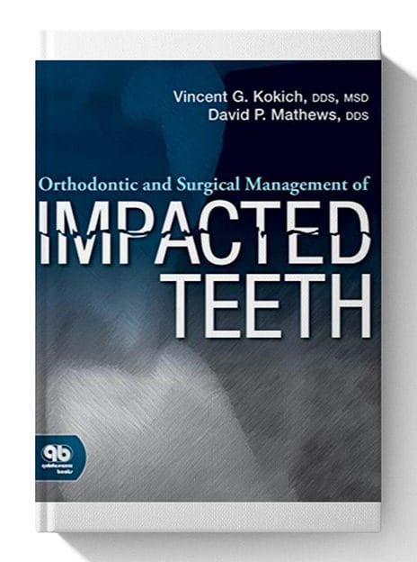 Orthodontic and Surgical Management of Impacted Teeth First Edition