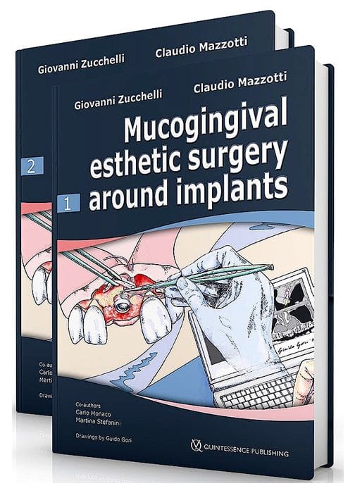 Mucogingival Esthetic Surgery Around Implants ( 2 Volumes)