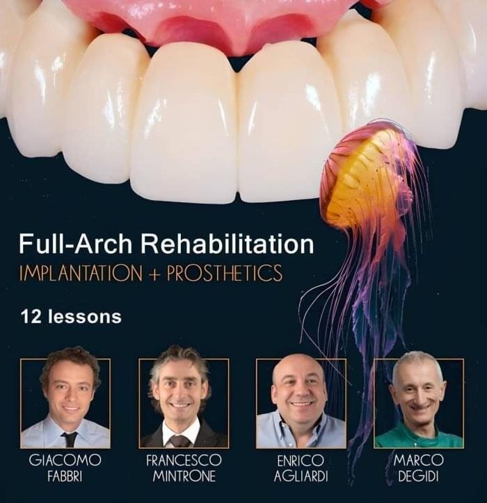 Full-Arch-Rehabilitation-Implantation-and-Prosthetics