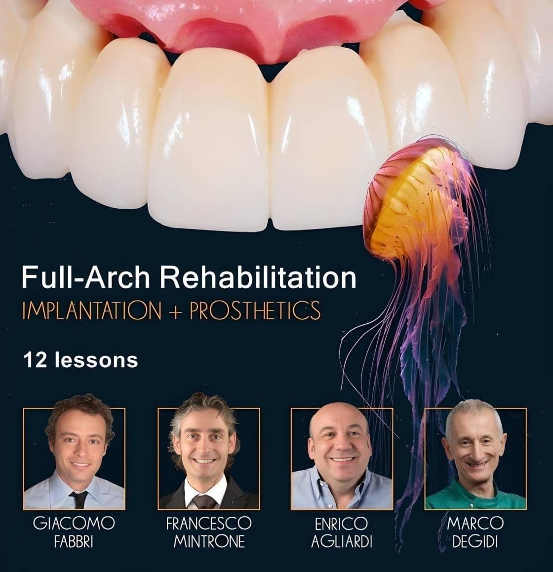 Full-Arch-Rehabilitation-Implantation-and-Prosthetics
