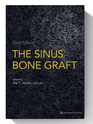 the sinus bone graft
