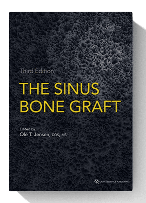 the sinus bone graft