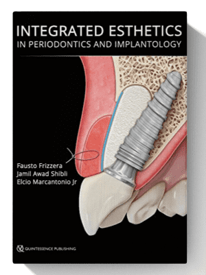 integrated esthetics in periodontics and implantology