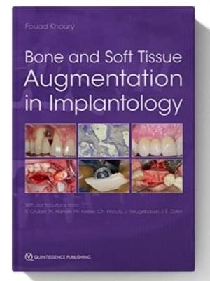 bone and soft tissue augmentation in implantology