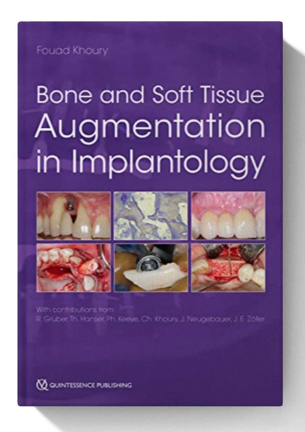 bone and soft tissue augmentation in implantology