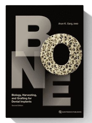 biology harwesting and framing for dental implants