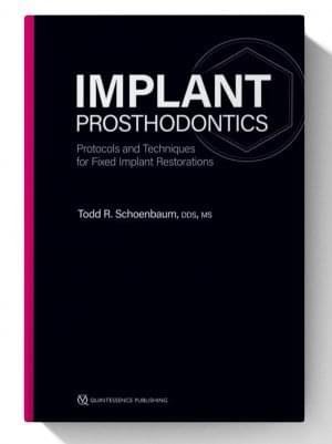 implant prosthodontics protocols and techniques