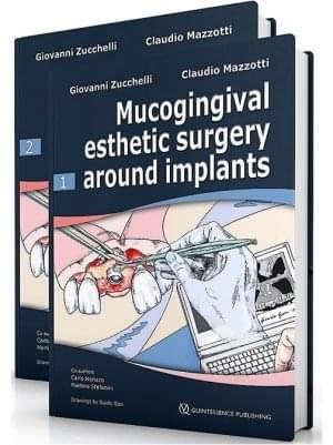 mucogingival esthetic surgery around implants 2 volumes