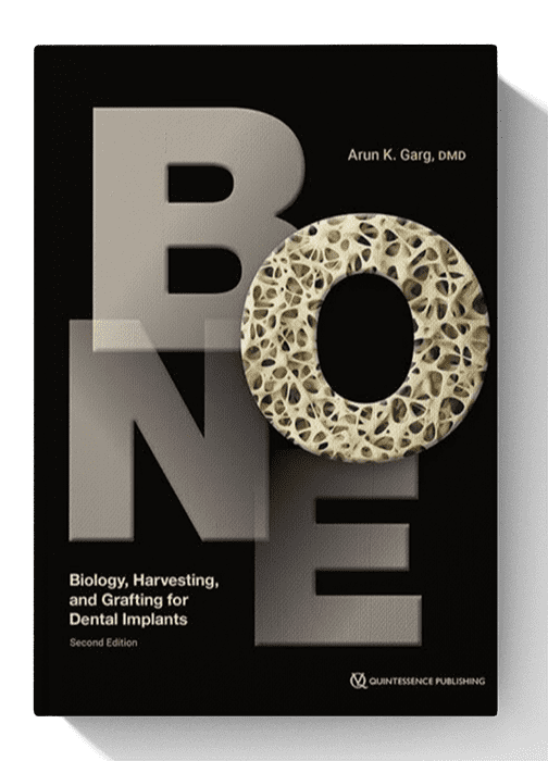 biology harwesting and framing for dental implants