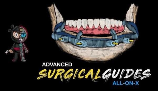 Implant-Ninja-Advanced-Surgical-Guides-All-on-X